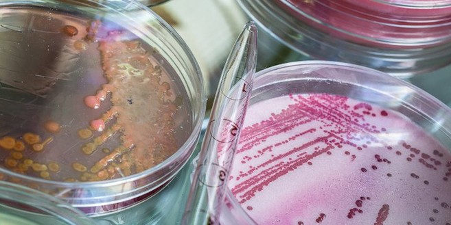 Allergen Tests Being Performed